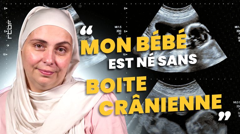 "Votre bébé n’a pas de boîte crânienne" : Sandra a accouché d’un bébé anencéphale