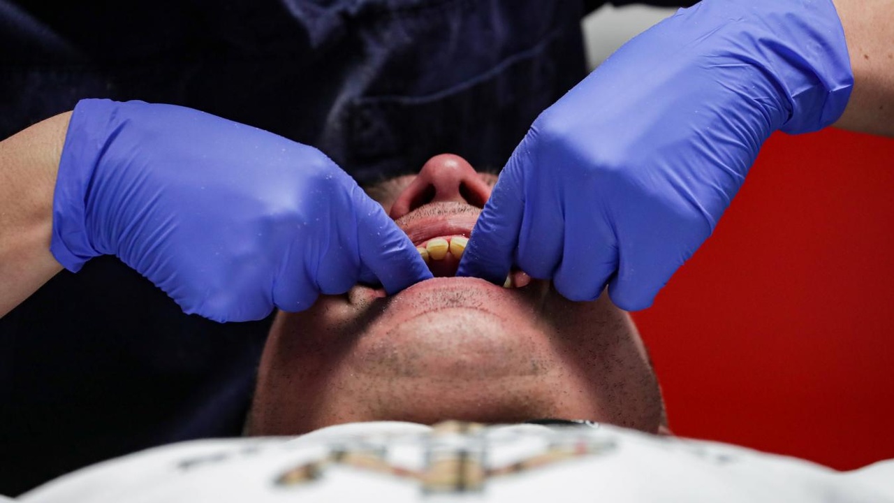 « Il m’a murmuré ‘encore un peu plus profond’, alors que j’allais vomir » : Carl, un dentiste belge, va être jugé pour des années de « fétichisme de la gorge »