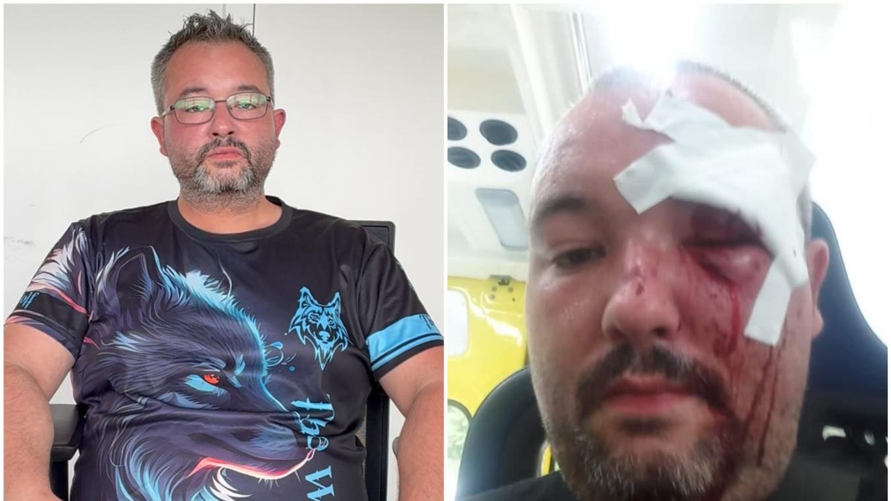 « Je ne dors plus la nuit, j’ai peur de le croiser » : tabassé à Verviers puis menacé avec une douille devant chez lui, Julien a perdu son travail et vit avec de lourdes séquelles (vidéo)