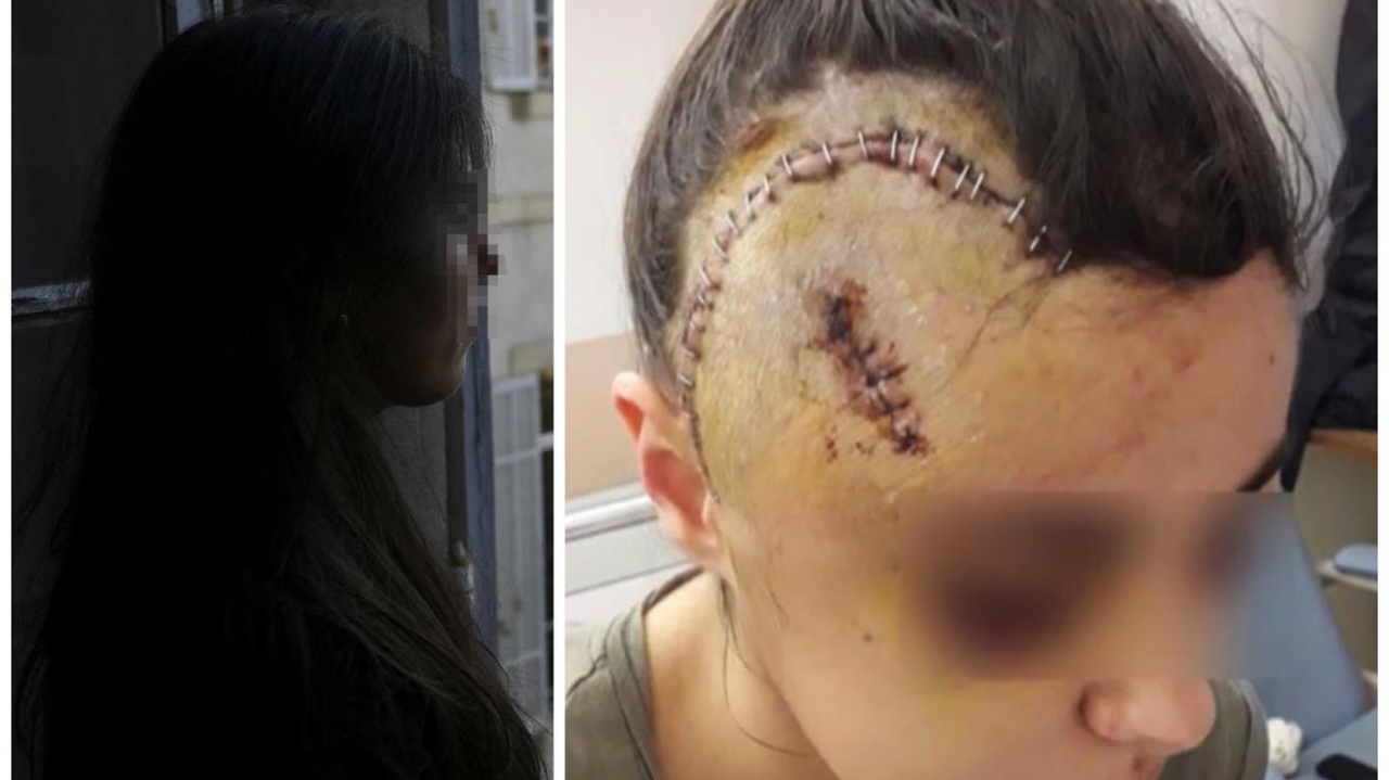 Ils avaient frappé Angelina jusqu’à lui fracturer le crâne : un commissaire français mis en examen pour avoir protégé ses policiers
